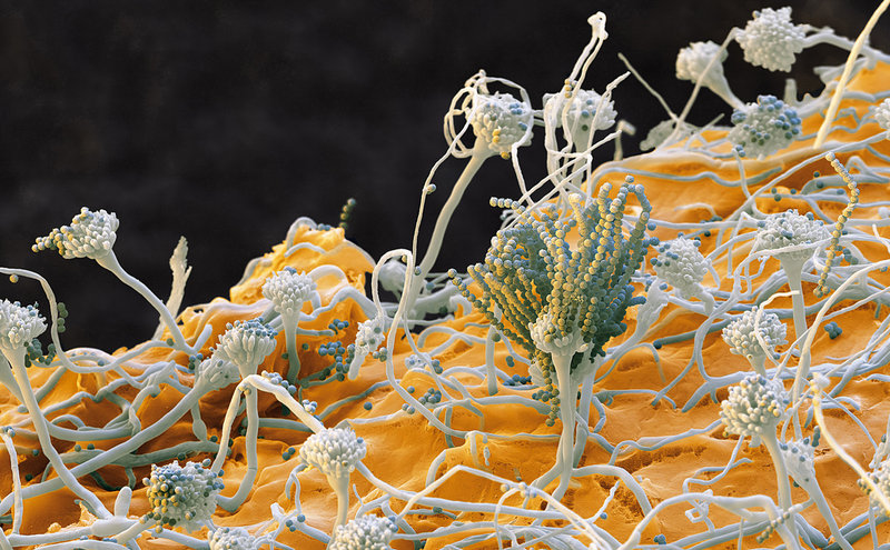 Illustration for article titled Photos of the Amazing and Gruesome World Under a Microscope
